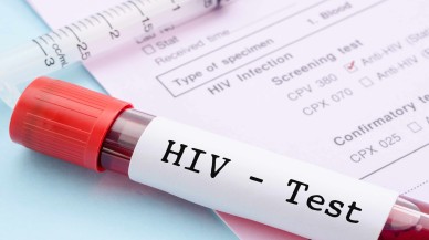 HIV Testi ile Bulaşıcı Hastalıklara Son
