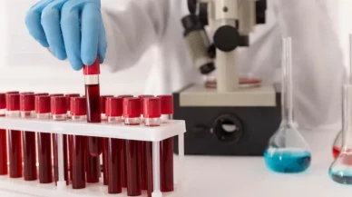 Hastalığa en çabuk yakalanan kan grubu belli oldu