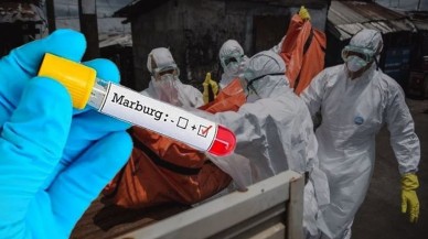 Şimdi de bu virüs çıktı! Bulaştığı kişilerde ölüm oranı yüzde 88