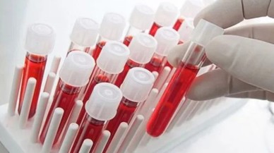 Felç riski en yüksek kan grubu belli oldu