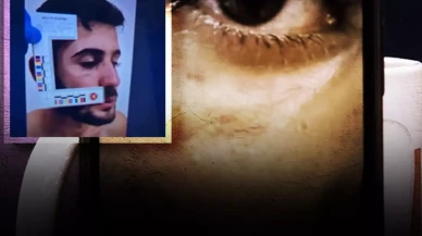 Soruşturmanın seyrini değiştirecek gelişme: Ağabey Enes Güran'ın yüzündeki morluk ve ısırık izleri...