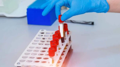 Bu kan grubuna sahip insanların ciltleri kırışmıyor