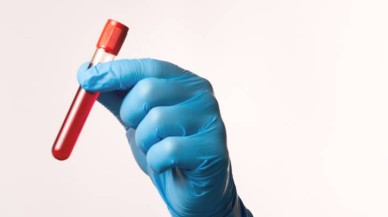 EOS (Eozinofil) Nedir? İnsan Sağlığındaki Rolü ve Önemi