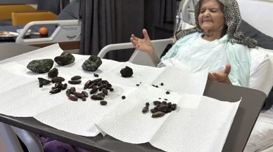 Yuttuğu zeytin ve hurma çekirdekleri başına iş açtı!