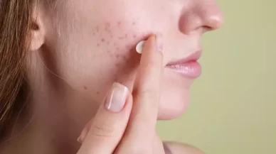 Türkiye'de de satış yapan Fransız devi,  ünlü kremini toplatıyor