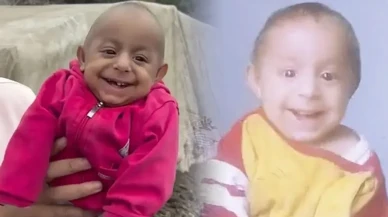 Sosyal medyada 'Gülen Bebek' olarak tanınan Ökkeş bebek yaşamını yitirdi