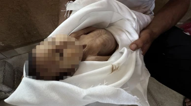 DSÖ: Gazze’de yetersiz beslenmeye bağlı 400 ölüm doğrulandı