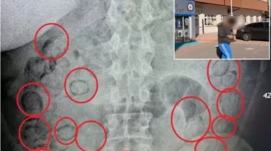 Aksaray'da pes dedirten olay! Midesinden 433 gram metamfetamin çıktı