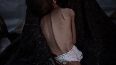 Gazze’de açlık krizi derinleşiyor: Can kaybı 455’e çıktı