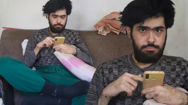 3 yıldır tırnaklarını kesmeyen ve duş almayan gencin eski hali ortaya çıktı