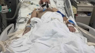 Adam Grubu'nun Solisti Mykhailo Klymenko Komada: Eşi dua istedi