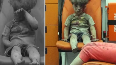 Dünya gündemine oturan Ümran bebeğin son hali.. Yürekleri burktu