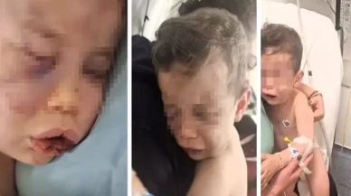 2 yaşındaki bebek annesinin sevgilisi tarafından öldüresiye dövüldü