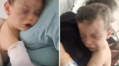 Annesinin sevgilisinin öldüresiye darbettiği Aren bebeği yakmaya çalışmışlar