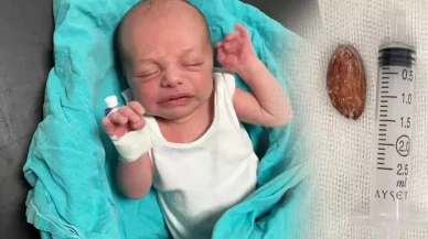 16 günlük Muhammed bebeğin yemek borusundaki şeker çıkarıldı