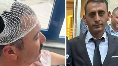 Belediye Başkan Yardımcısı'na şekerlikle saldıran Yeniden Refah Partili tutuklandı