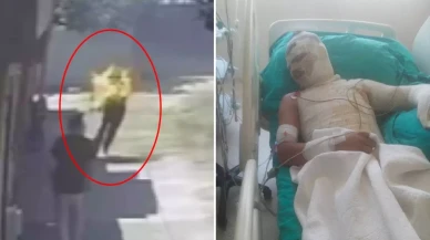 Yeğenini diri diri böyle yaktı