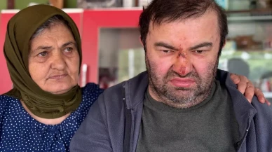 Bolu’da yürek burkan olay: Engelli Murat Kepil akrabası tarafından darp edildi!