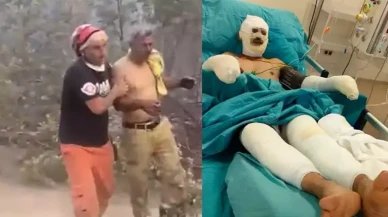 10 kişinin öldüğü yangından kurtulmuştu: Orman işçisinin hastanedeki görüntüleri ortaya çıktı
