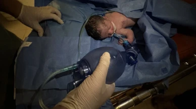 Gazze'de saldırıda ölen hamile kadının bebeği kurtarıldı