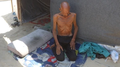 Gazzeli müezzini görenler şoke oluyor 70 kilogramdan bakın kaç kilograma düştü