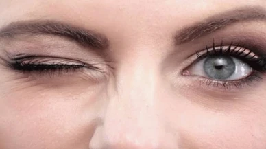 Göz seyirmesi hangi hastalığın belirtisi?