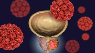 Erkeklerde en sık görülen ikinci kanser: Prostat kanseri