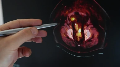 Obezite ve kanser arasındaki tehlikeli bağ!