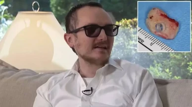 20 yıllık körlüğe son! Kendi dişi gözüne takıldı, görmeye başladı