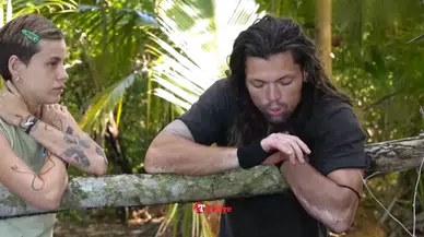 Survivor Onur Alp Çam'ın hastalığı ne? Ellerindeki sargıların, yüzündeki lekelerin sebebi ortaya çıktı