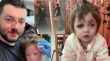 Yalova’daki darp olayında şüpheliden dikkat çeken ifade: 'Kasıtlı olarak çocuğa vurmadım'