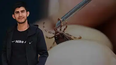 21 yaşındaki genç kene nedeniyle hayatını kaybetti