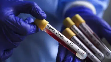 Dünya Sağlık Örgütü açıkladı: Kongo’daki salgında 3 bin 267 kişi öldü