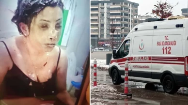 Bunun adı saf kötülük! Eşini koli bandıyla bağlayıp kezzapla yaktı