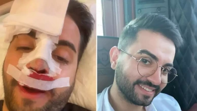 Kadir Ezildi’nin burnu neden sargılı? Fotoğrafın perde arkası ortaya çıktı