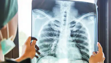 Sessiz salgın geri döndü: Beyaz veba yeniden yayılıyor!