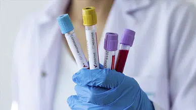 DSÖ Ebola salgınının risk düzeylerini açıkladı