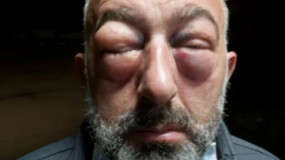 Kocaeli'de halk otobüsü şoförlerinden yolcuya dayak