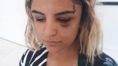 Kısmet Ağar dini nikahlı eşi tarafından öldürülme korkusuyla yaşıyor