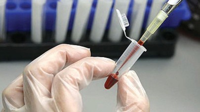 30 dakika içinde bakteri ölçen cihaz geliştirildi