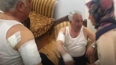 Belediye Başkanına köpek saldırdı: 'Adeta beni parçalamaya çalıştı'