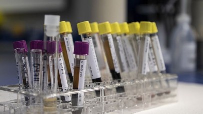 Bir dönem öldüren genetik hastalık önlenebilir hale geldi