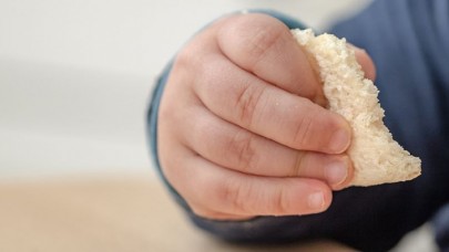 Çocukluk çağı besin alerjilerinin görülme oranı arttı