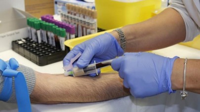 Damarlardaki pıhtı herkesin ortak problemi