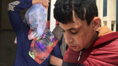 Komşusu ve çocuklarına kezzapla saldırdı,  savunması 'pes' dedirtti!