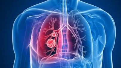 40 yaş üstü her 5 kişiden birinde KOAH tehlikesi