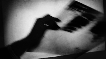 Tüberküloz tanı ve tedavi rehberi güncellendi