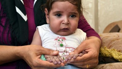 Yarım kalple dünyaya gelen minik Miraç,  yaşama tutunamadı 