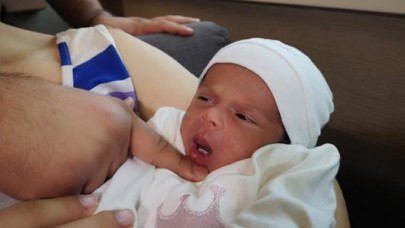 3 bin doğumda bir görülüyor... Dişleriyle dünyaya geldi