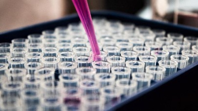 Açlık hormonu eylemsel hafızayı artırıyor